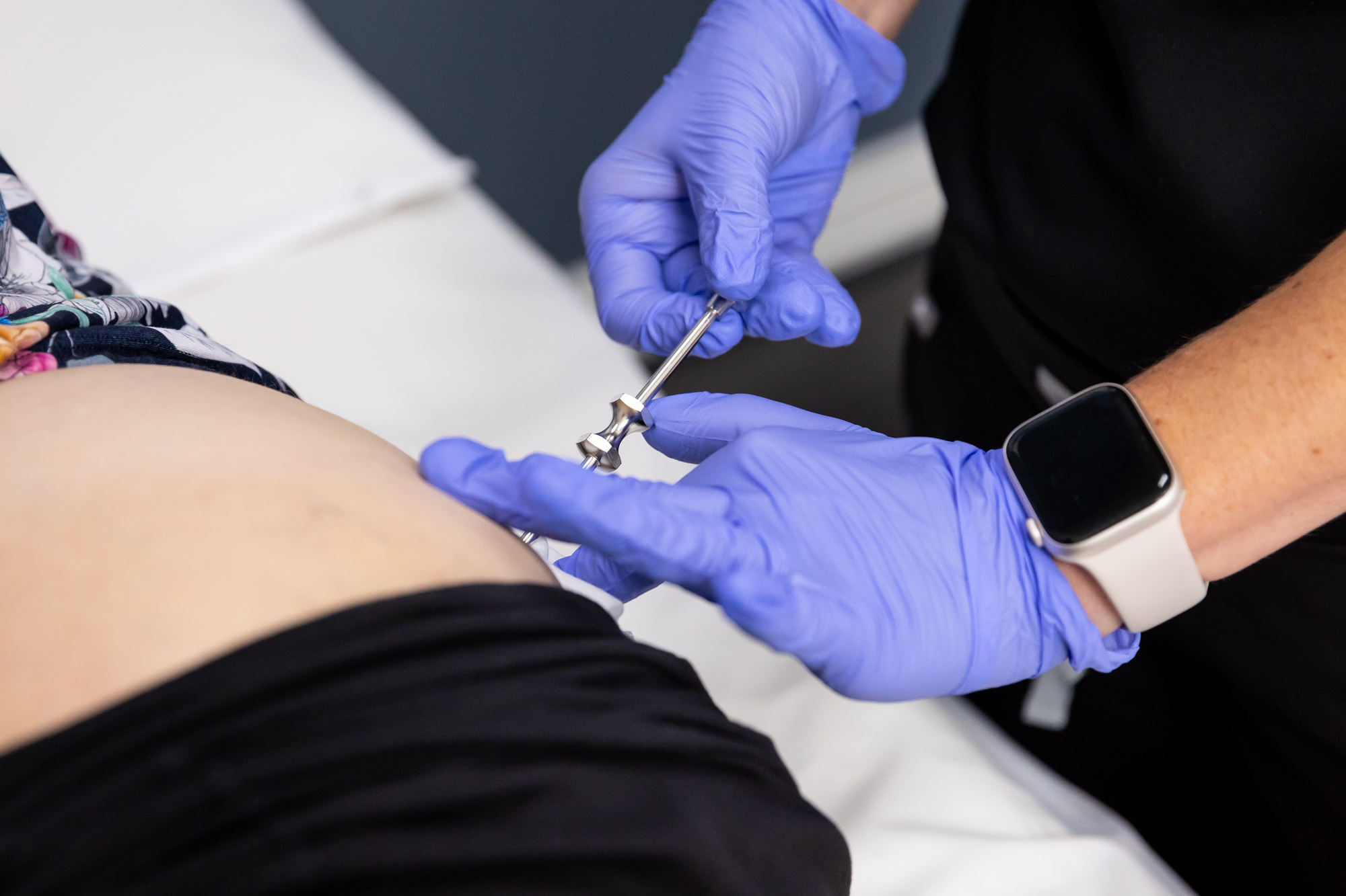 The blue-gloved hands of a provider use a specialized instrument to insert hormone pellets into the hip of a female patient as part of her treatment plan including gynecology near Fort Worth.