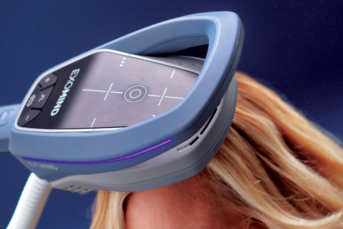 A close-up of a female patient receiving EXOMIND transmagnetic therapy