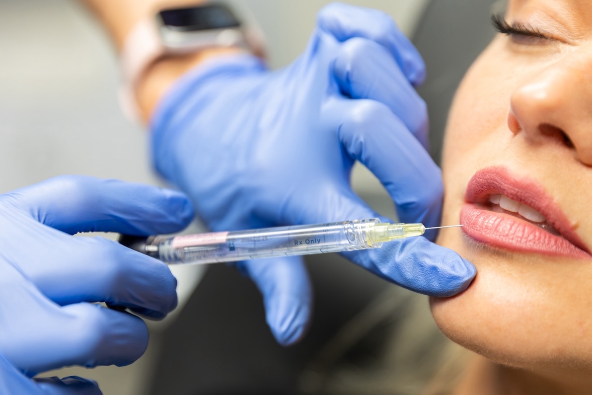 Close-up of a provider administering lip fillers in Prosper.